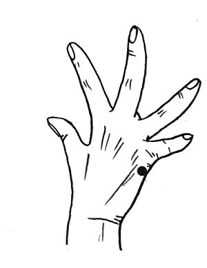 \