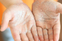 日本发现诺如病毒变异或致流行扩大 做预防先得勤洗手