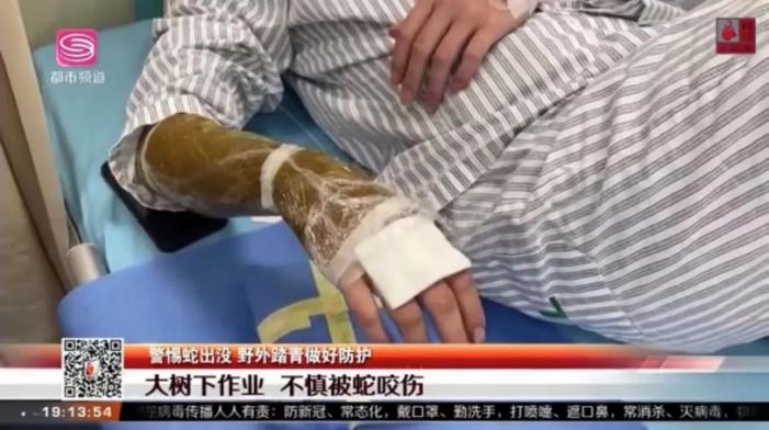 春夏季要小心，深圳今年已有9人因蛇伤呼叫120急救！